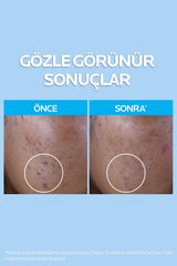 La Roche Posay Yağlı ve Akneye Eğilim Gösteren Cilt Tipleri İçin Effaclar Yüz Temizleyici ve Arındırıcı Jel 400 ml
